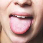 Reasons-Mouth-Dryness