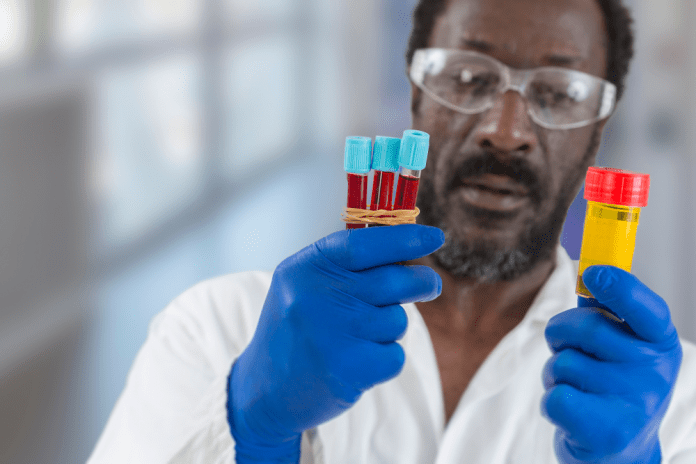 what-causes-blood-in-the-urine-allhealthuse